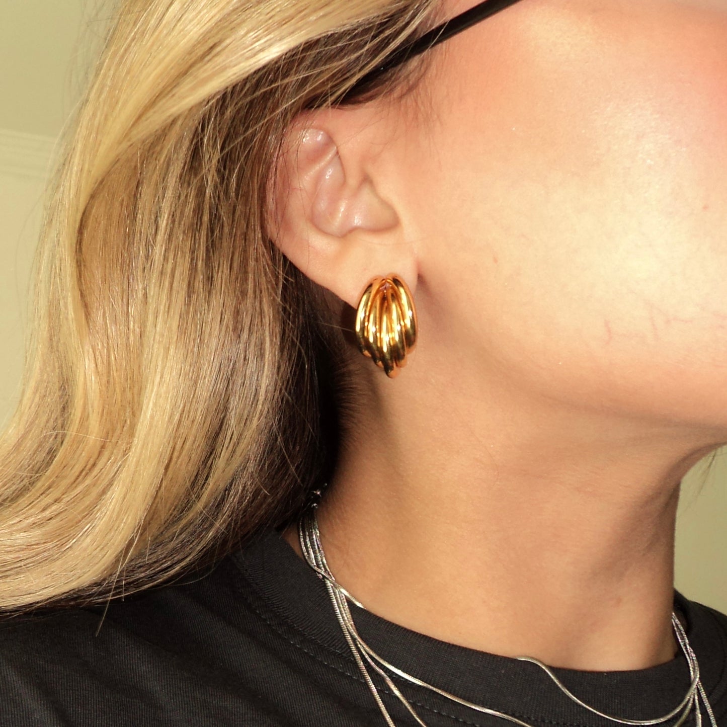 ARETES NIX